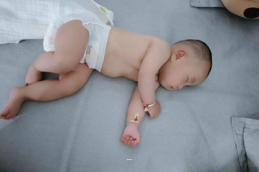 惠州宝宝脸上有白色斑块 惠州宝宝脸上有白色斑块